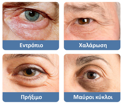 OpenEyes™ | Τζελ αναζωογόνησης ματιών (1+1 ΔΩΡΕΑΝ)